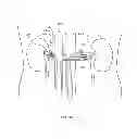 Fig. 07 - METHODS AND DEVICES FOR THERMALLY INDUCED HEPATIC NEUROMODULATION
