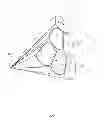 Fig. 77 - METHODS AND DEVICES FOR THERMALLY INDUCED HEPATIC NEUROMODULATION