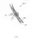 Fig. 37 - METHODS AND DEVICES FOR THERMALLY INDUCED HEPATIC NEUROMODULATION