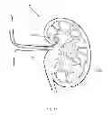 Fig. 48 - METHODS AND DEVICES FOR THERMALLY INDUCED HEPATIC NEUROMODULATION
