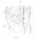 Fig. 58 - METHODS AND DEVICES FOR THERMALLY INDUCED HEPATIC NEUROMODULATION