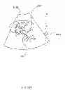 Fig. 69 - METHODS AND DEVICES FOR THERMALLY INDUCED HEPATIC NEUROMODULATION