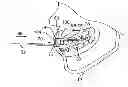 Fig. 01 - Swallowing air pulse therapy mouthpiece and method for the use thereof