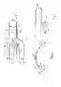 Fig. 02 - Swallowing air pulse therapy mouthpiece and method for the use thereof