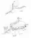 Fig. 06 - Swallowing air pulse therapy mouthpiece and method for the use thereof