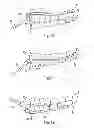 Fig. 07 - Swallowing air pulse therapy mouthpiece and method for the use thereof