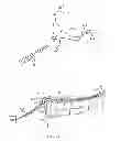 Fig. 15 - Swallowing air pulse therapy mouthpiece and method for the use thereof