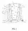 Fig. 02 - Heel protector and corresponding rehabilitation systems and methods for using the same