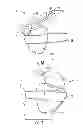 Fig. 09 - Reconfigurable Shoulder and Arm Orthosis and Method