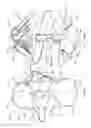 Fig. 05 - Orthopedic device and method for securing the same