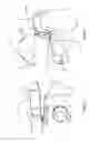 Fig. 07 - Orthopedic device and method for securing the same