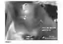Fig. 02 - Method of providing agents to the cochlea