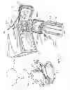 Fig. 02 - Peritoneal dialysis systems and related devices and methods