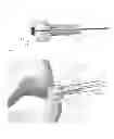 Fig. 13 - Deployable joint infection treatment system