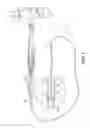 Fig. 02 - Catheter deflection anchor