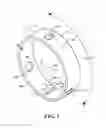 Fig. 05 - Catheter deflection anchor