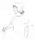 Fig. 01 - Adhesive and peripheral systems and methods for medical devices