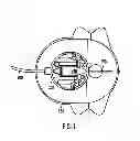 Fig. 02 - MEDICATION INFUSION SET