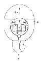 Fig. 03 - MEDICATION INFUSION SET