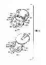 Fig. 11 - MEDICATION INFUSION SET