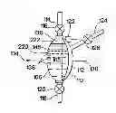 Fig. 01 - Fluid pumping apparatus for use with a removable fluid pumping cartridge