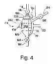 Fig. 06 - Fluid pumping apparatus for use with a removable fluid pumping cartridge