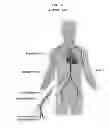 Fig. 07 - Hemostasis valve device