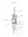 Fig. 03 - INSTILLATOR FOR INJECTION OF RINGER'S SOLUTION