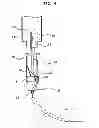 Fig. 05 - INSTILLATOR FOR INJECTION OF RINGER'S SOLUTION