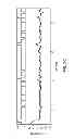 Fig. 09 - Auto-regulation system for intraocular pressure