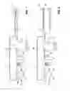 Fig. 02 - System for aspirating fluids from a body using negative pressure