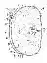 Fig. 04 - Dressing assemblies for wound treatment using reduced pressure