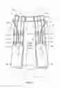 Fig. 02 - Drainage bag support apparatus