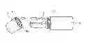 Fig. 01 - Catheter activation by handle removal
