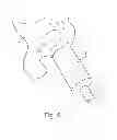 Fig. 03 - Catheter activation by handle removal