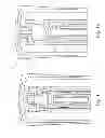 Fig. 07 - Catheter activation by handle removal