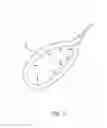 Fig. 04 - Assembly for urinary drainage