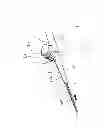 Fig. 03 - REMOVABLE CLIP FOR CATHETER