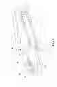 Fig. 02 - SUBCUTANEOUS AND INTRADERMAL PATCH INFUSERS