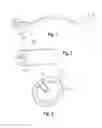 Fig. 02 - CATHETER WITH AN ENHANCED PUSHABILITY