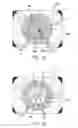 Fig. 06 - SYSTEM AND METHOD OF PERFORMING FEMTOSECOND LASER ACCOMODATIVE CAPSULOTOMY