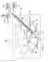 Fig. 11 - SYSTEM AND METHOD OF PERFORMING FEMTOSECOND LASER ACCOMODATIVE CAPSULOTOMY