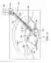 Fig. 18 - SYSTEM AND METHOD OF PERFORMING FEMTOSECOND LASER ACCOMODATIVE CAPSULOTOMY