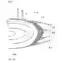 Fig. 06 - Ophthalmologic laser device and method for preventing and treating aftercataract