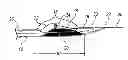Fig. 01 - Biasing laser catheter: monorail design
