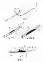 Fig. 02 - Biasing laser catheter: monorail design