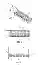 Fig. 03 - Biasing laser catheter: monorail design