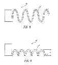 Fig. 04 - Biasing laser catheter: monorail design