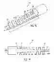 Fig. 05 - Biasing laser catheter: monorail design