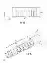 Fig. 07 - Biasing laser catheter: monorail design
